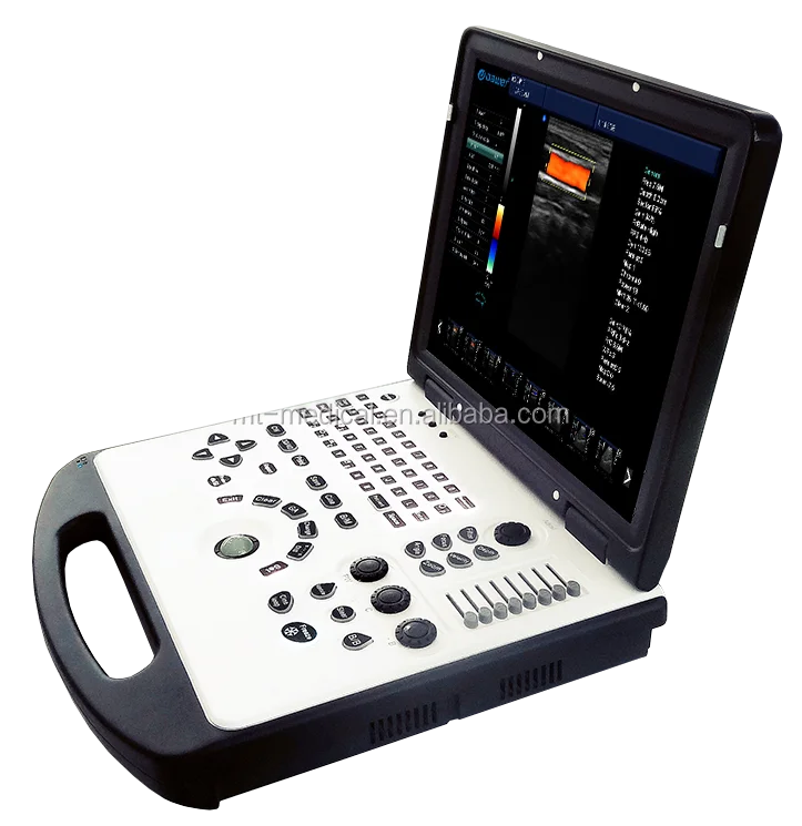 Doppler color Ultrasonido equipos portable ipad ultrasound Scanner Hospital Equipment