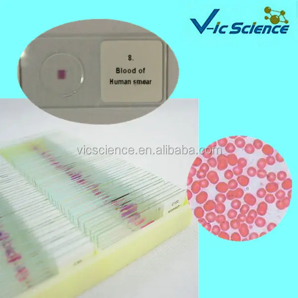 Hematology Prepared Slides Blood Smear Prepared Slides Buy Hematology