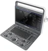 Excellent MSK diagnosis doppler laptop ultrasound Sonoscape E2