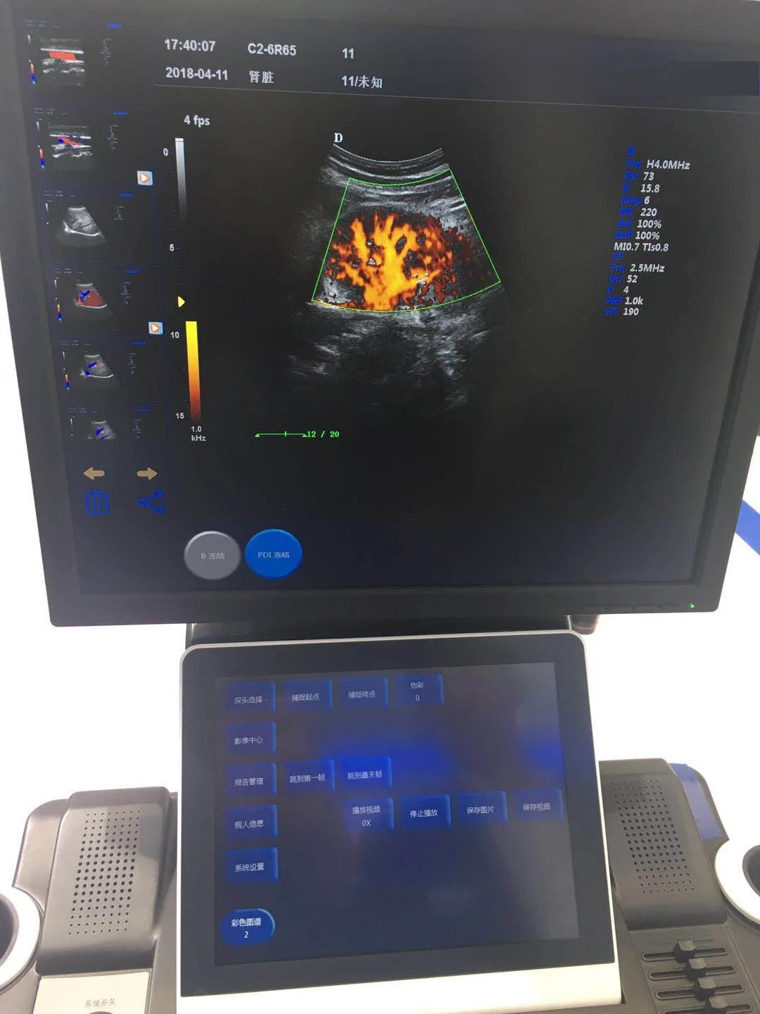Cheap hospital best ultrasoundmachine 3d 4d ultrasound machine same as DC 8