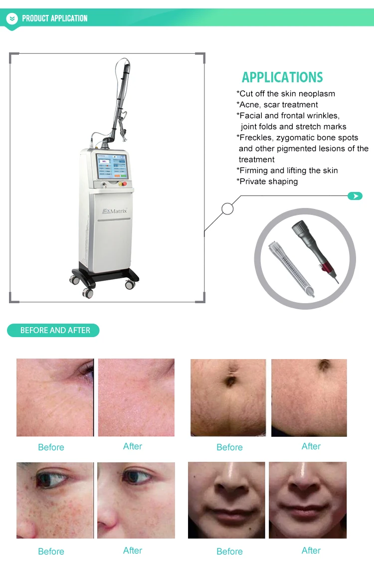 Beijing sincoheren 10600Nm Medical Vaginal Tightening Fractional Co2 Laser Equipment