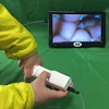 Self - Inspection Tool For Cervical Examination Digital Electronic Colposcope Applicable Individual Clinic And Hospital