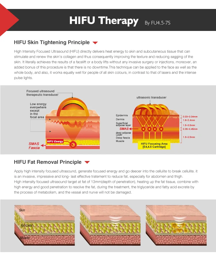 Hottest portable hifu machine 4 transducers mini hifu for face lift body slimming