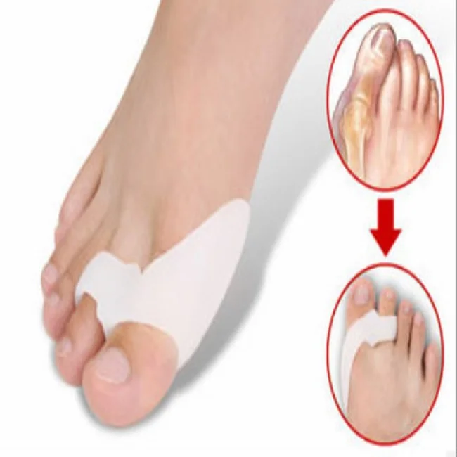 Неврома мортона стельки. Выпрямление пальцев на ногах. Как выпрямить большой палец на ноге. Исправление косточки на ноге. Бандаж-шина bunion aid hinged splint for bunions корректор большого пальца.