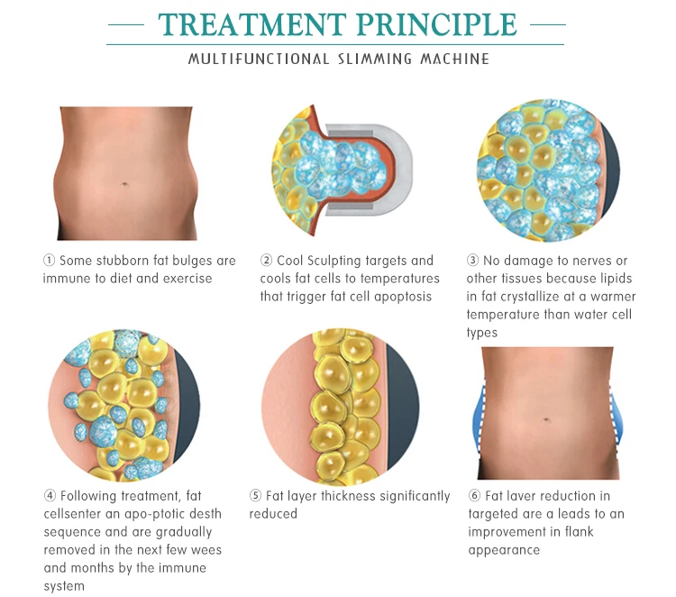 Cheap Price Freezefats Machine Brand for Sale 2 Handles