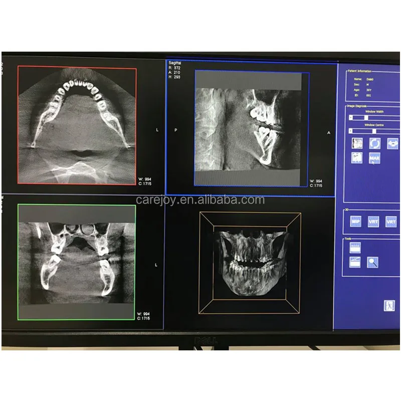 CBCT (6).jpg