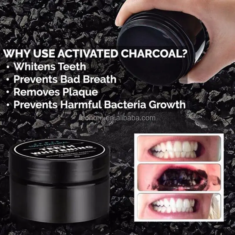 Teeth whitening-07.jpg