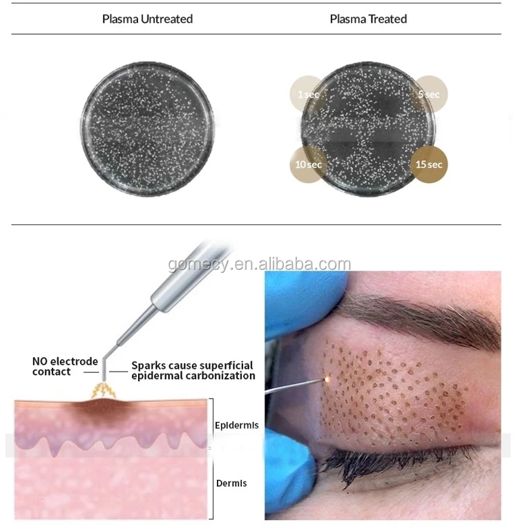 GOMECY Medical Plasma shower handle surginal or needle handle machine skin rejuvenation for antibacterial antivirus.jpg