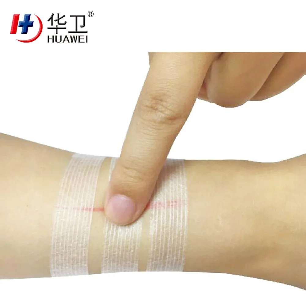 Surgical Tape Wound Closure Steristrip Skin Closures Buy Surgical