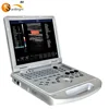 Powerful LED hospital liver scanning test color doppler ultrasound