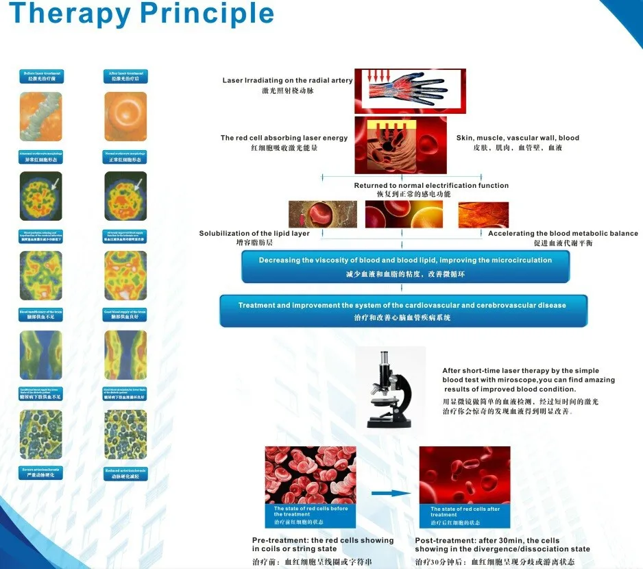 China new painless no drug no side effect physical wrist watch 6 lasers lllt 650nm laser treatment apparatus