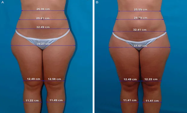 "В Донецке" - Косметика в Волноваха - OLX.ua