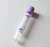 New launched ESR analyzer for medical blood sediment test