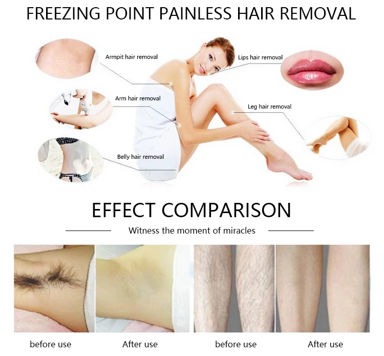 Useful Small Pain Free Effective IPL 360 OPT Hair Removal Machine