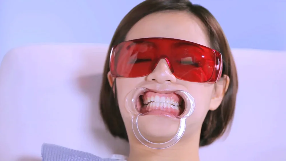 Dental Mouth Opener 80
