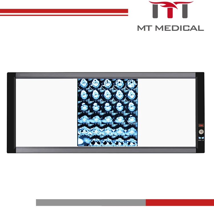 Portable Medical Led X Ray Negatoscope Triple Machine