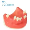 Fantastic Quality Dental Implant Practice Model for Dental Students