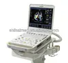 CX-50 cardiology ultrasound system