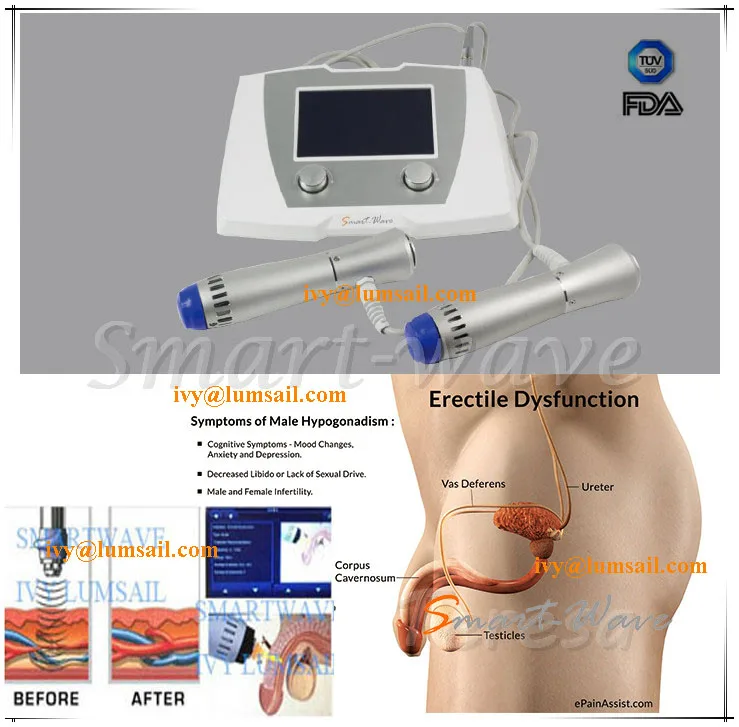 terapia de ondas de choque prostatitis terapia de ondas de choque prostatitis