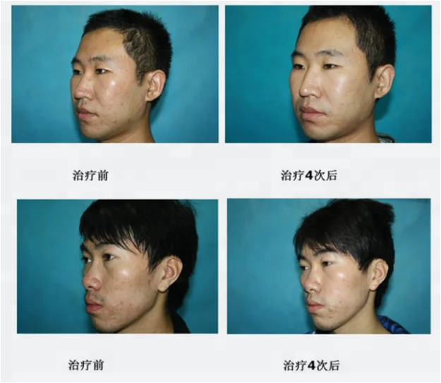 1550 before and after -1