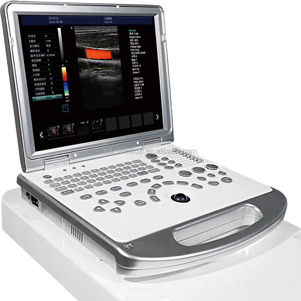 Digital Portable Ultrasound Scanner Diagnostic System For Sale