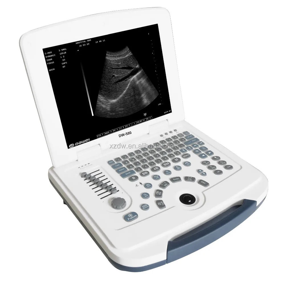 Dw580 Cheapest Portable Ultrasound Machine & Mini Laptop Usg Buy Mini