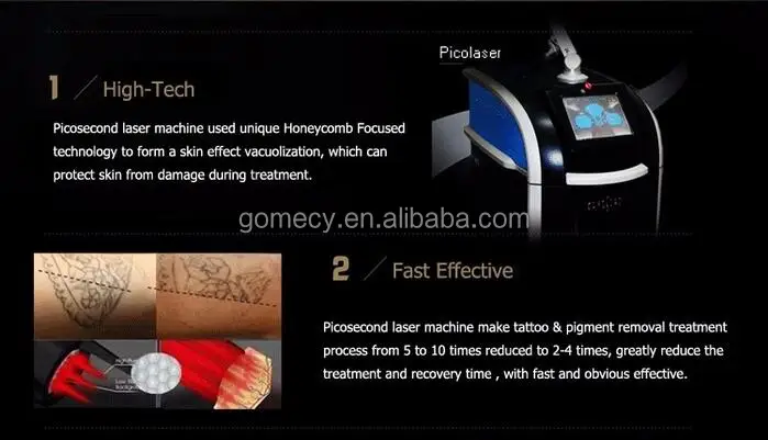 hot-sale-professional-picolaser-picosecond-cynosure-laser-fda-q-switched-nd-yag-laser-tattoo-removal-machine.jpg