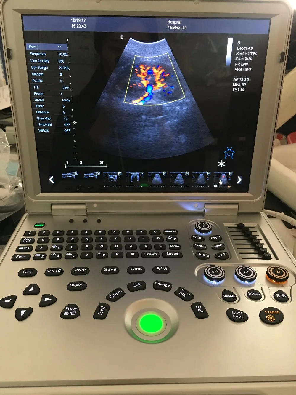 Dw-l5 New Designed 4d Doppler Ultrasound With Ce Approved - Buy Doppler