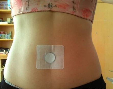 Gewichtsverlust Patches sind wirksame Patches