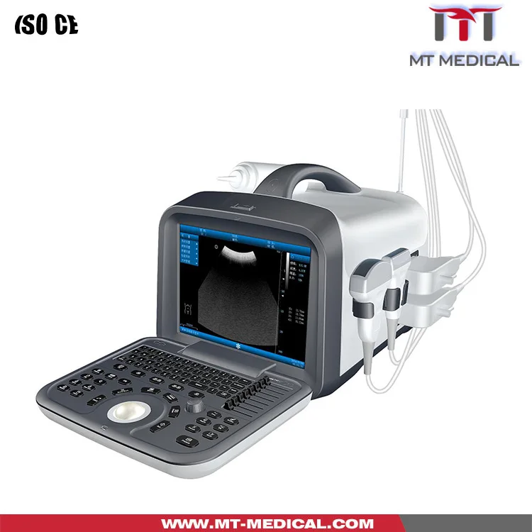 Ultrasonic USG ultrasound Scanner portable ultrasound usg