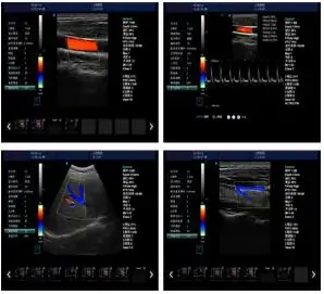 full digital 3D color portable ultrasound machine