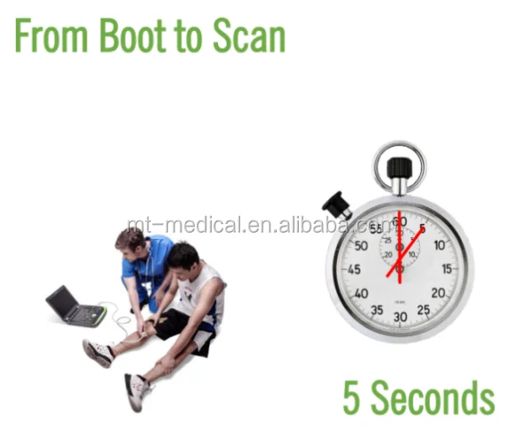 Ultrasound Cart Medical Equipment Portable Scanner