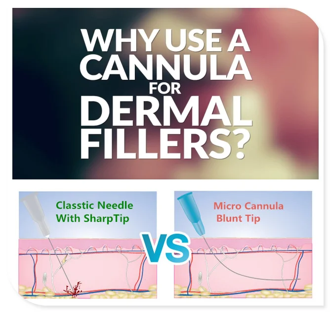 best selling types and sizes of cannula blunt tip needle for filler syringe