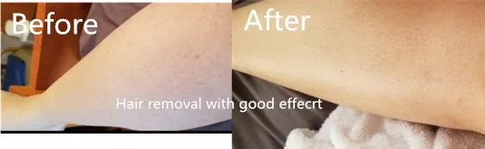 before after 1.jpg