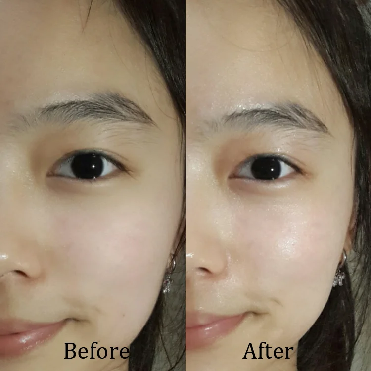750MBeforeAfter