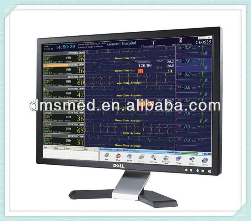 Wireless Ecg Telemetry Monitoring System - Buy Wireless Ecg Telemetry ...