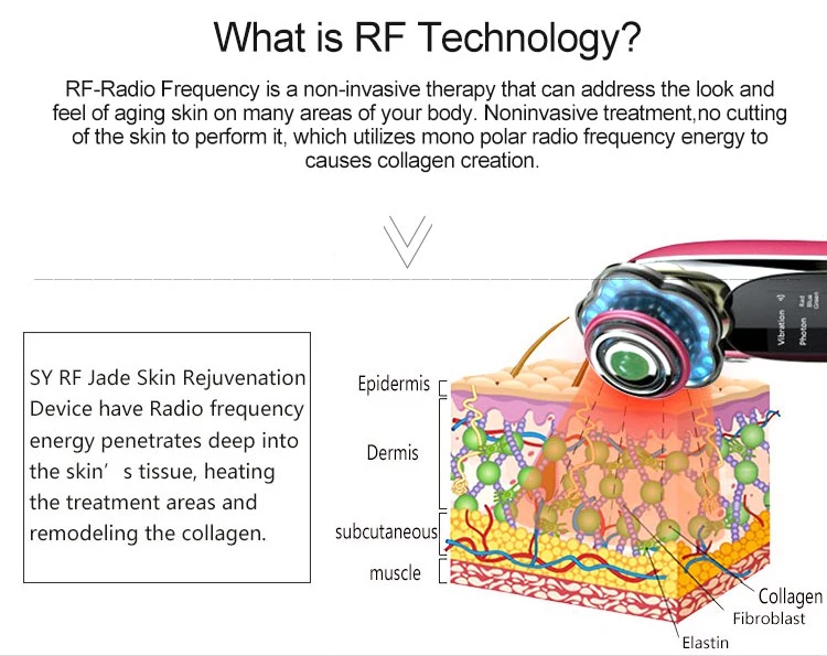 RF_05.jpg