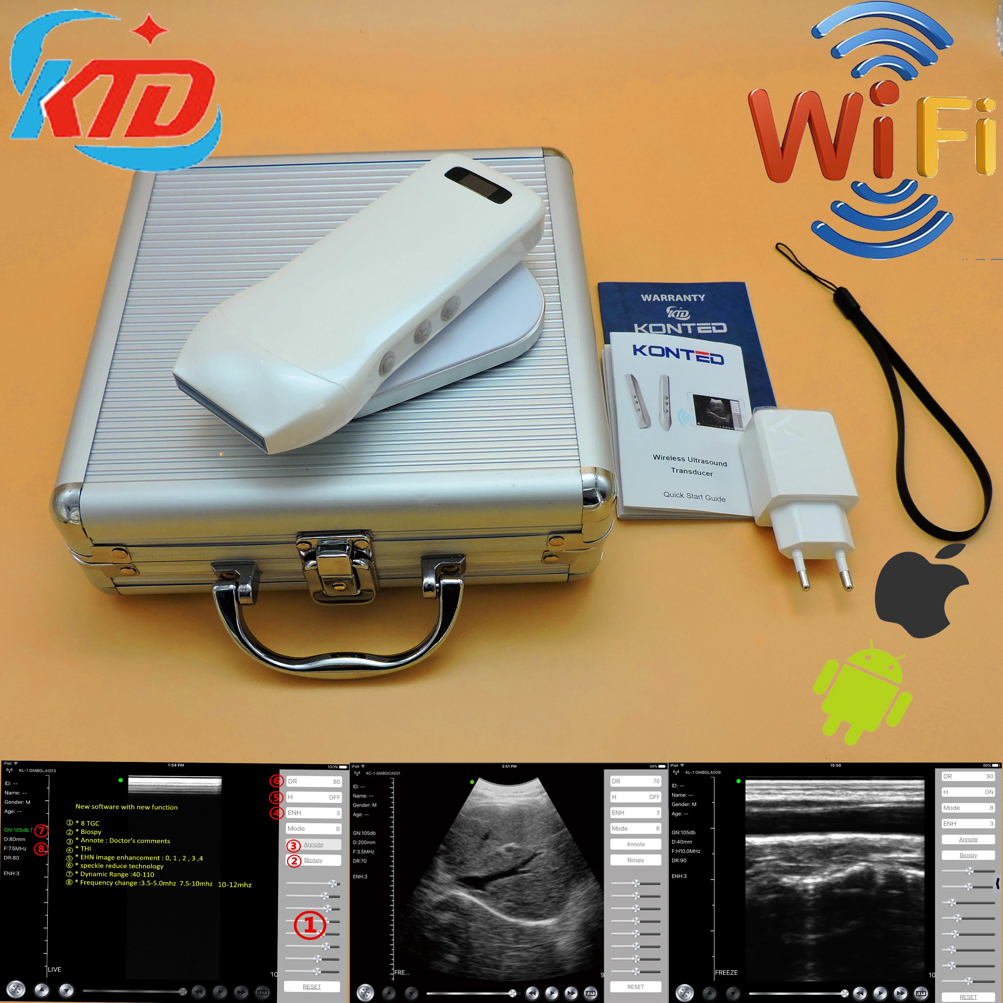 wireless ultrasound 111.jpg