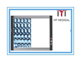 Portable Medical Led X Ray Negatoscope Triple Machine