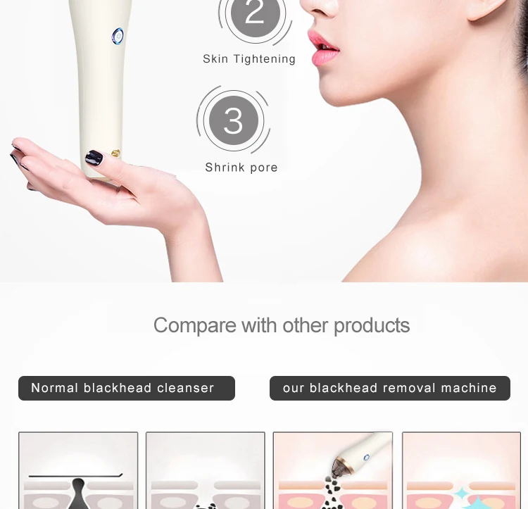electric blackhead remover