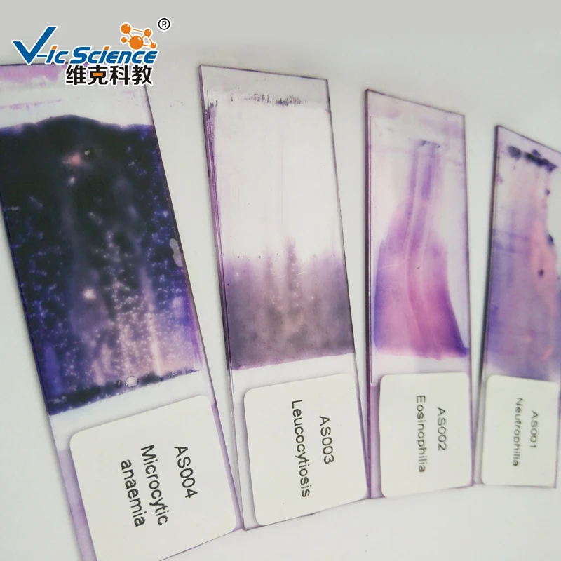 Lames Préparées Au Microscope,Lames Préparées Par Hématologie,Lames Préparées De Frottis De Sang