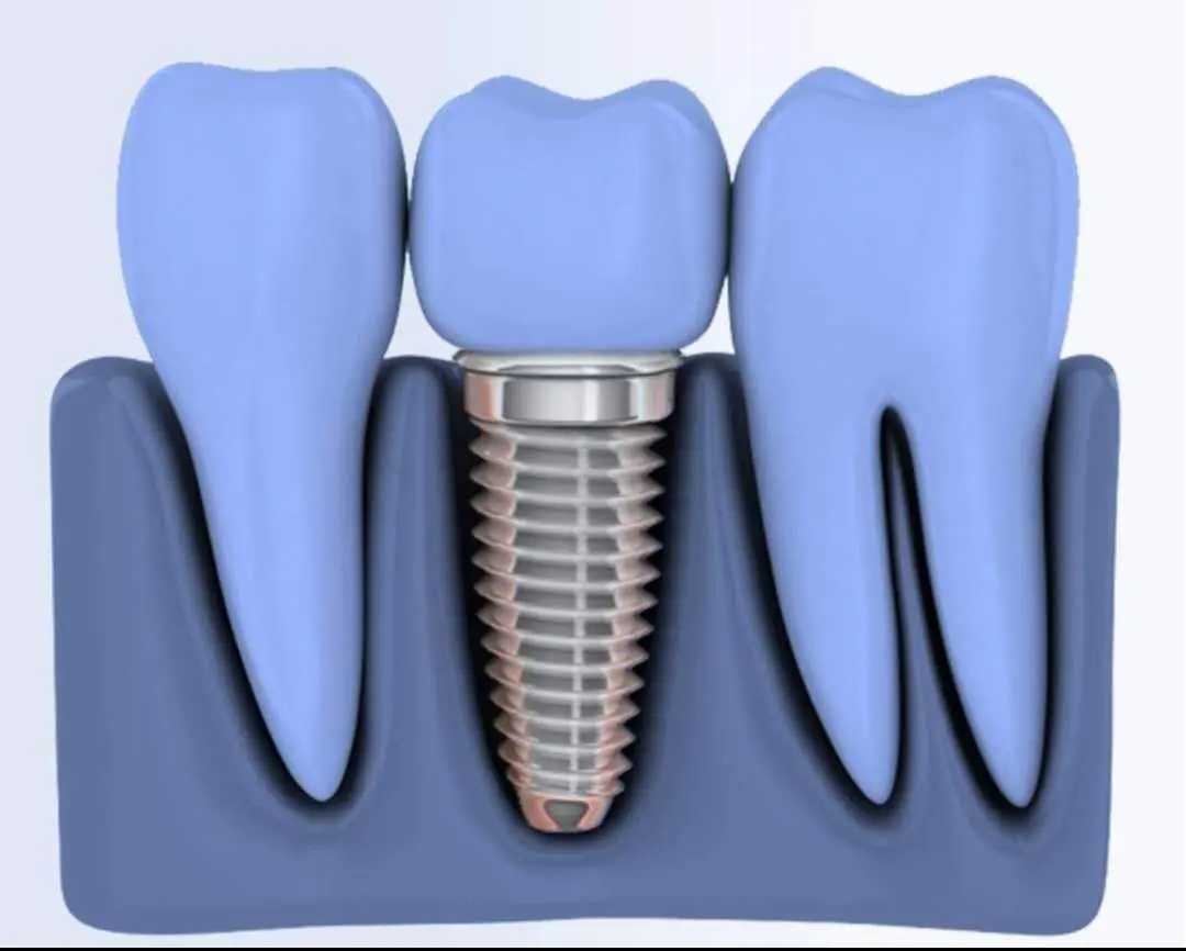 Hot Sale! Medical Grade Peek Rod For Surgical Implant!!! 316mm In