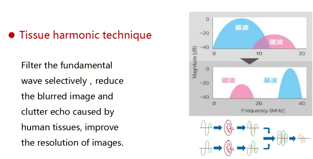 Ultrasonic USG ultrasound Scanner portable ultrasound usg