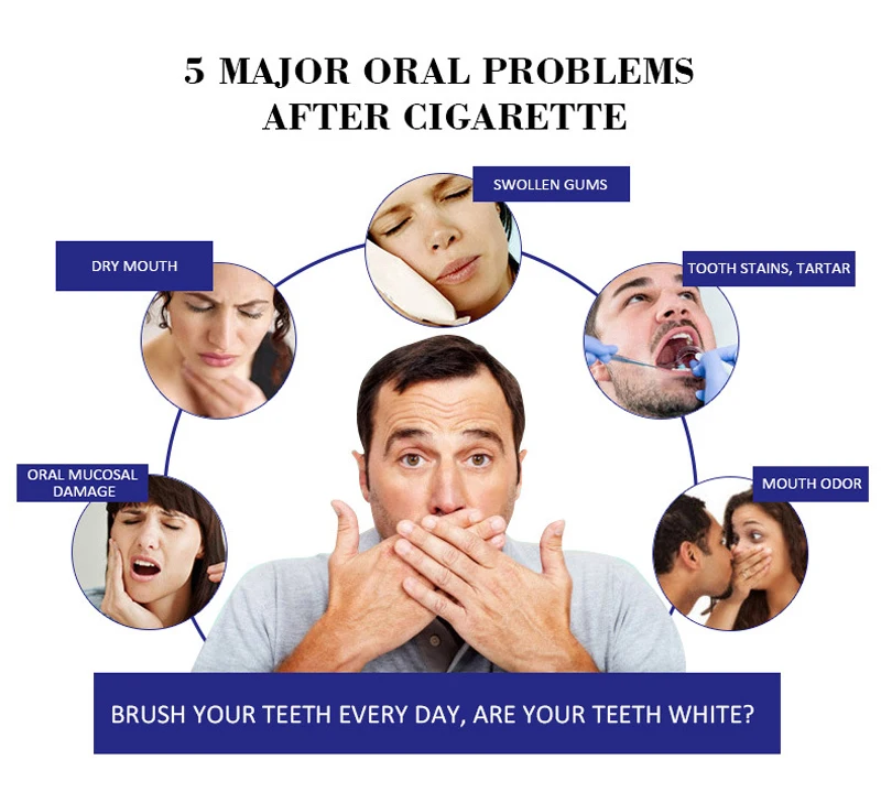 teeth whitening (5).jpg