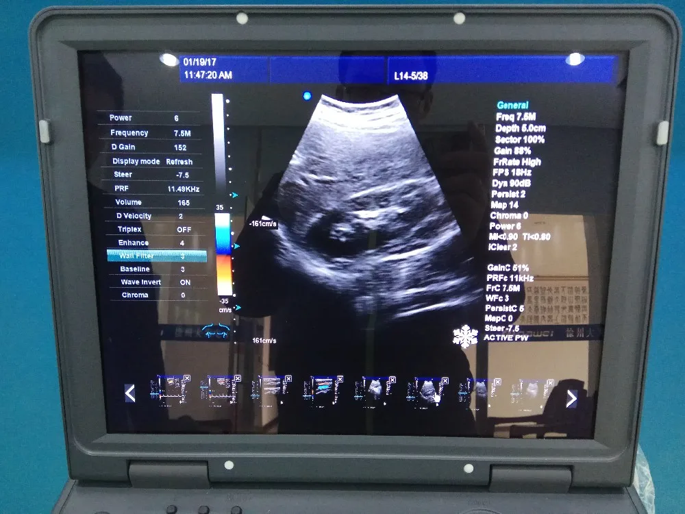 Doppler color Ultrasonido equipos portable ipad ultrasound Scanner Hospital Equipment