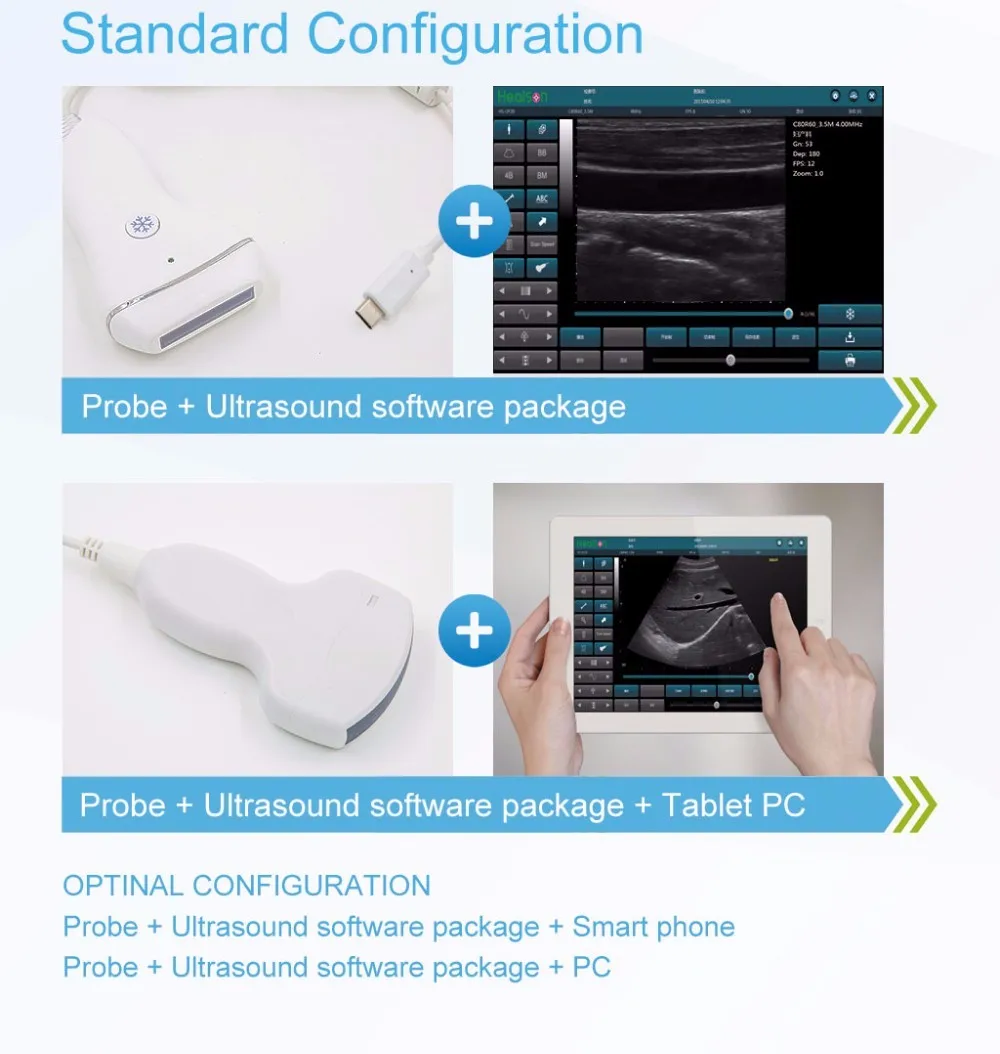 New Arrival Handheld Ipad Ultrasound Scanner Usb 7.5mhz Linear Probe