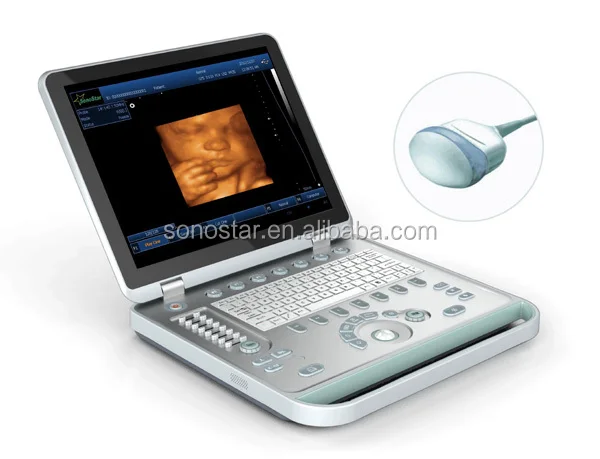 Ultrasound B Scanner Portable B Scanner SS 10Plus(zt1)01