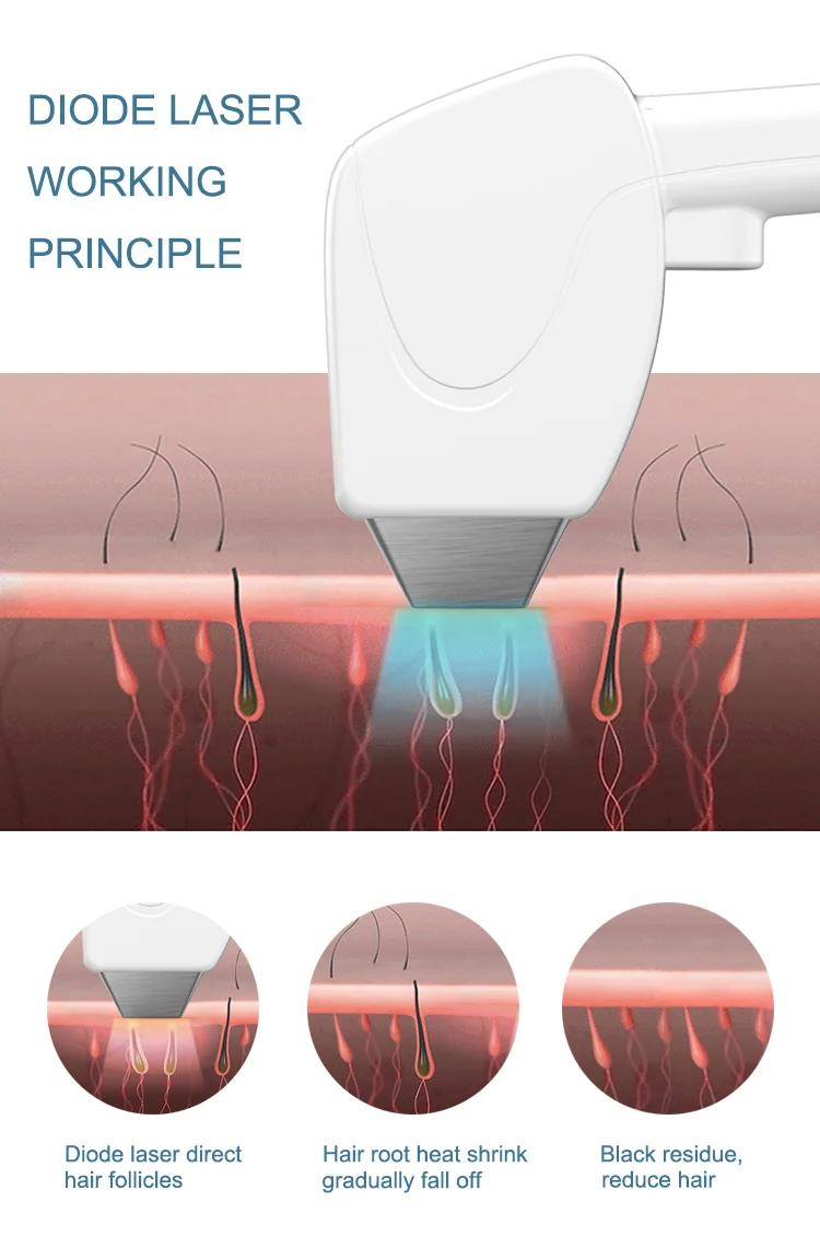 2019 new design 808nm diode laser hair removal/ professional laser hair removal machine