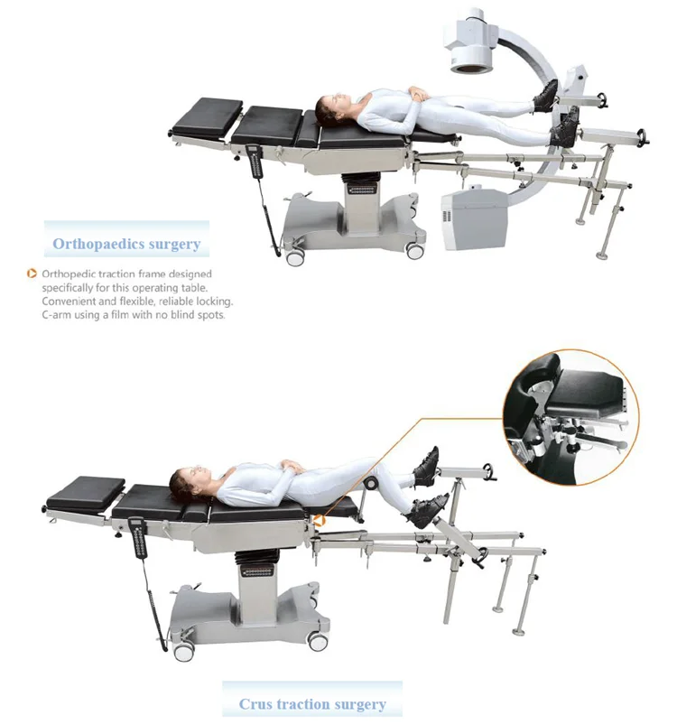 Multi functional electric operating table stainless steel table frame electric operation table