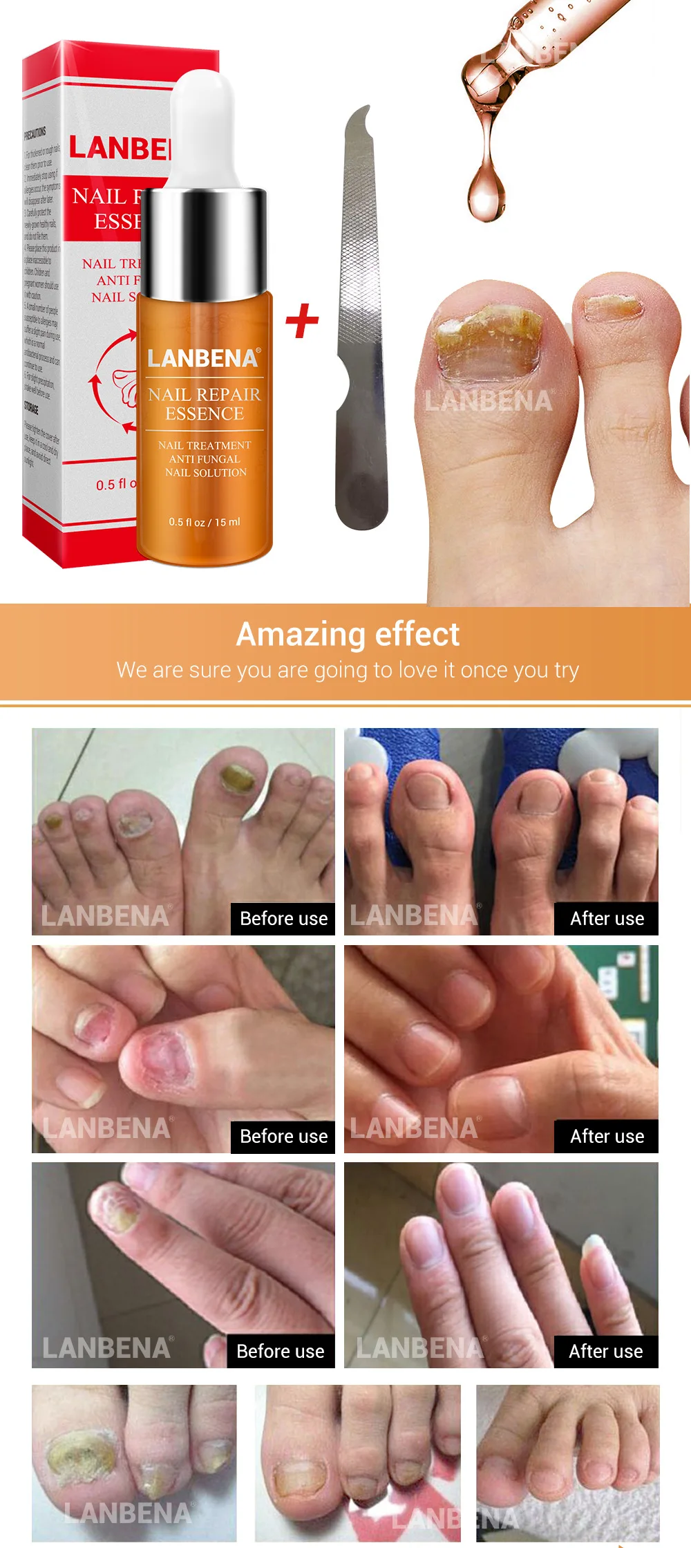 LANBENA Nail Care Gel Nail Foot Protector Skin Care Treatment Herb Nail Repair Essence